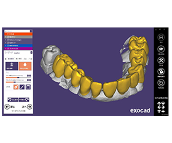 exocad