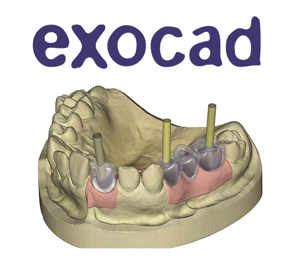 exocadインプラントベーシックコース