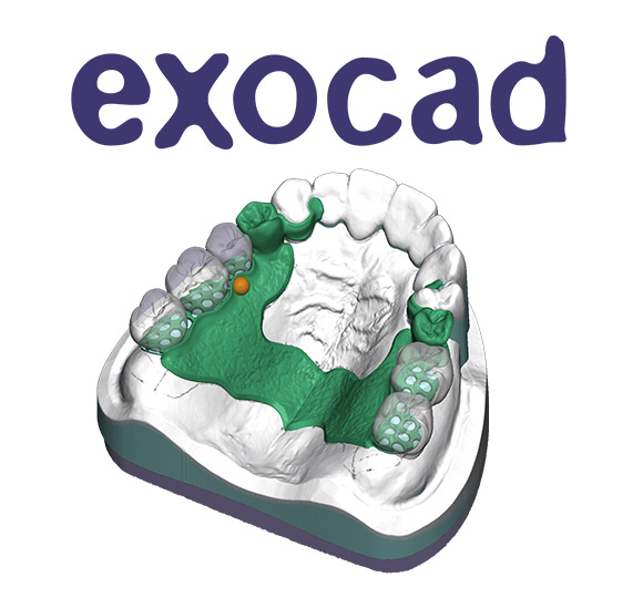 exocadデンチャーコース